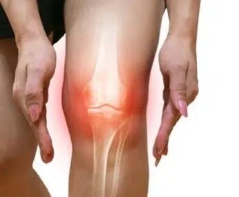 Knie artrose