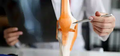 Hamstring-quadriceps-patellapees-of-donor-graft
